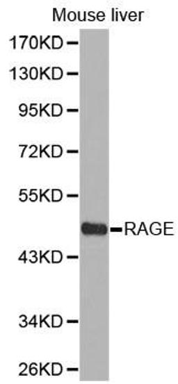 Western blot analysis of extracts of mouse liver cell lines using RAGE antibody