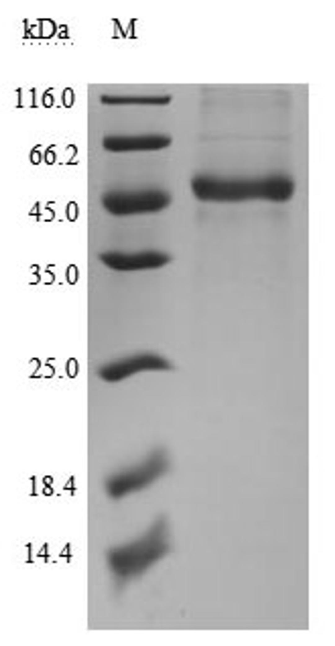 (Tris-Glycine gel) Discontinuous SDS-PAGE (reduced) with 5% enrichment gel and 15% separation gel.