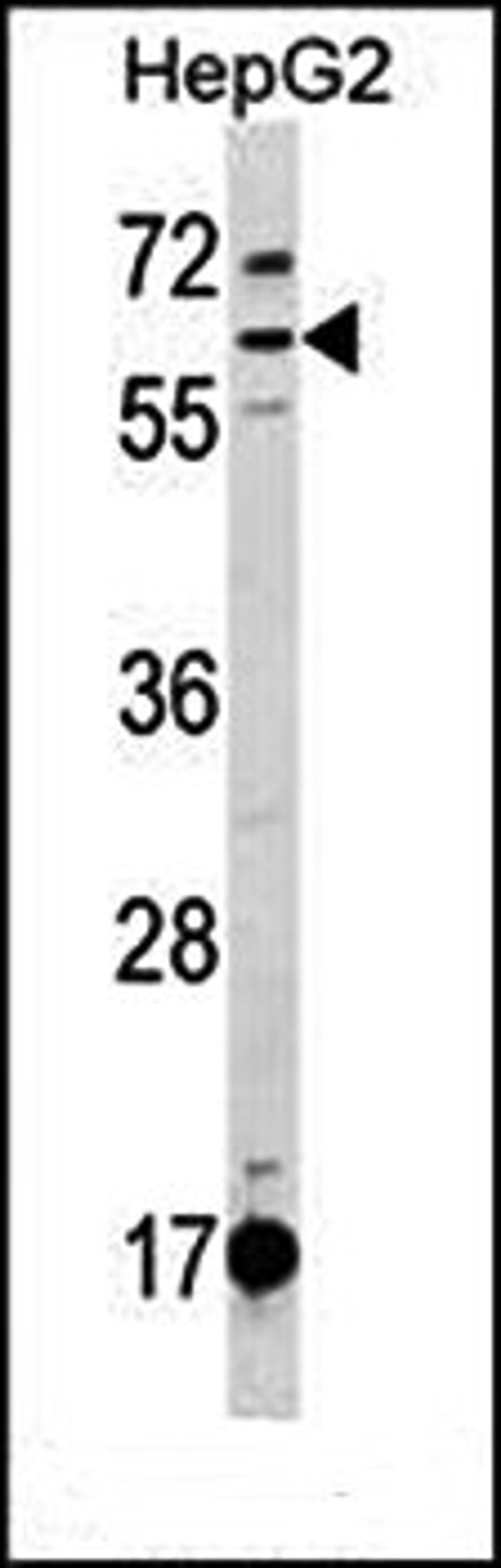 Western blot analysis of HepG2 cell line lysates (35ug/lane) using DEPDC1B (C-term) antibody