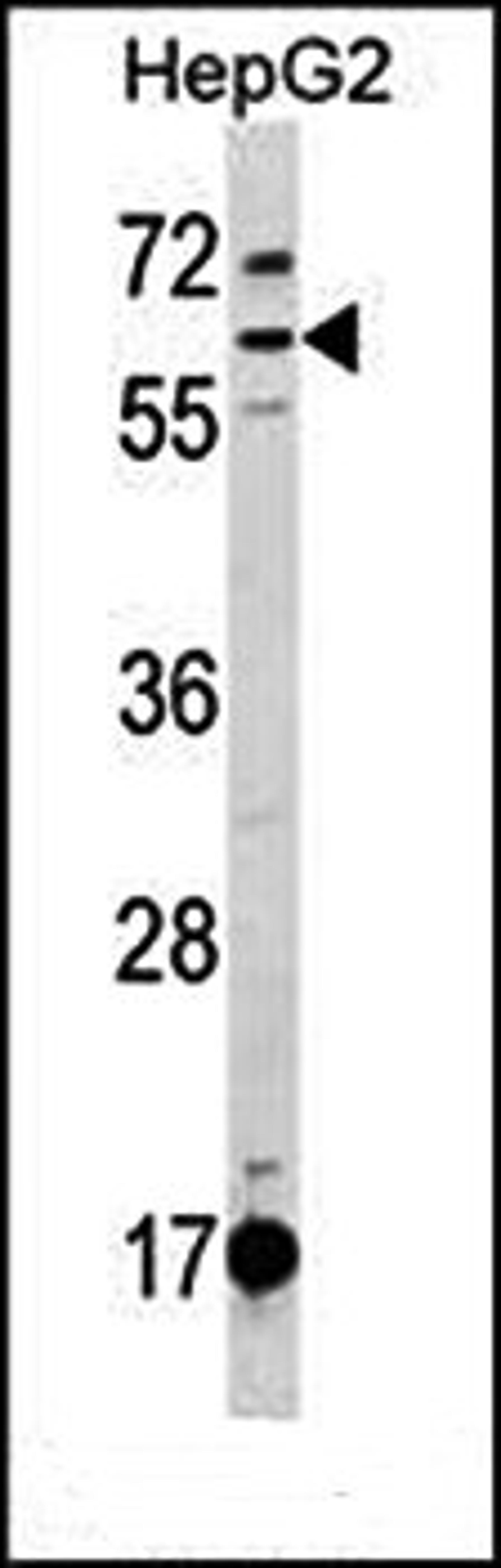 Western blot analysis of HepG2 cell line lysates (35ug/lane) using DEPDC1B (C-term) antibody