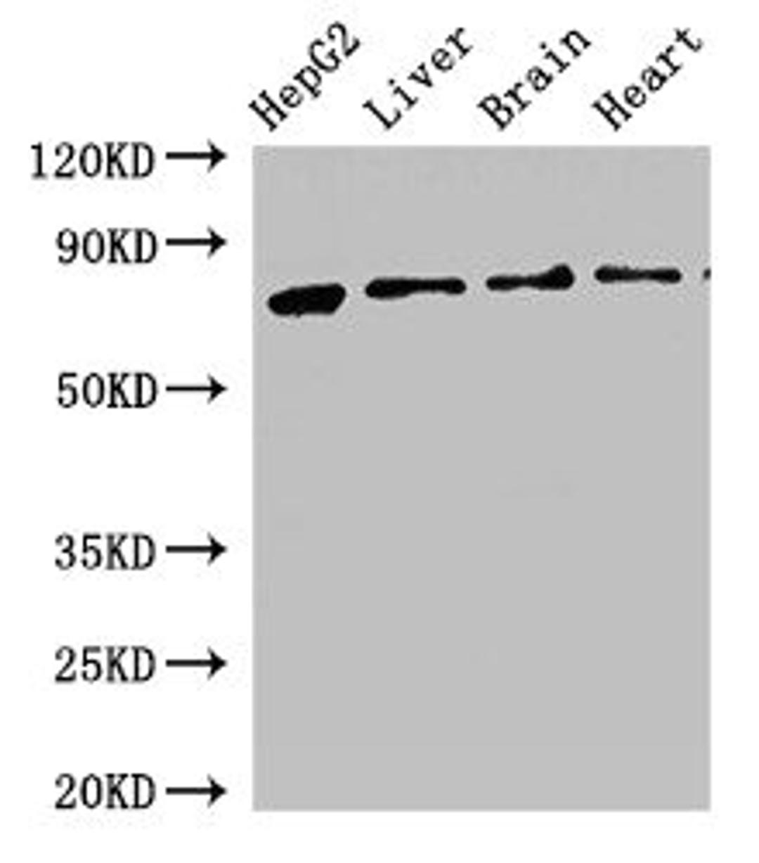 Western Blot. Positive WB detected in: HepG2 whole cell lysate, Rat liver tissue, Rat brain tissue, Mouse heart tissue. All lanes: KLKB1 antibody at 2.5ug/ml. Secondary. Goat polyclonal to rabbit IgG at 1/50000 dilution. Predicted band size: 72 kDa. Observed band size: 72 kDa.