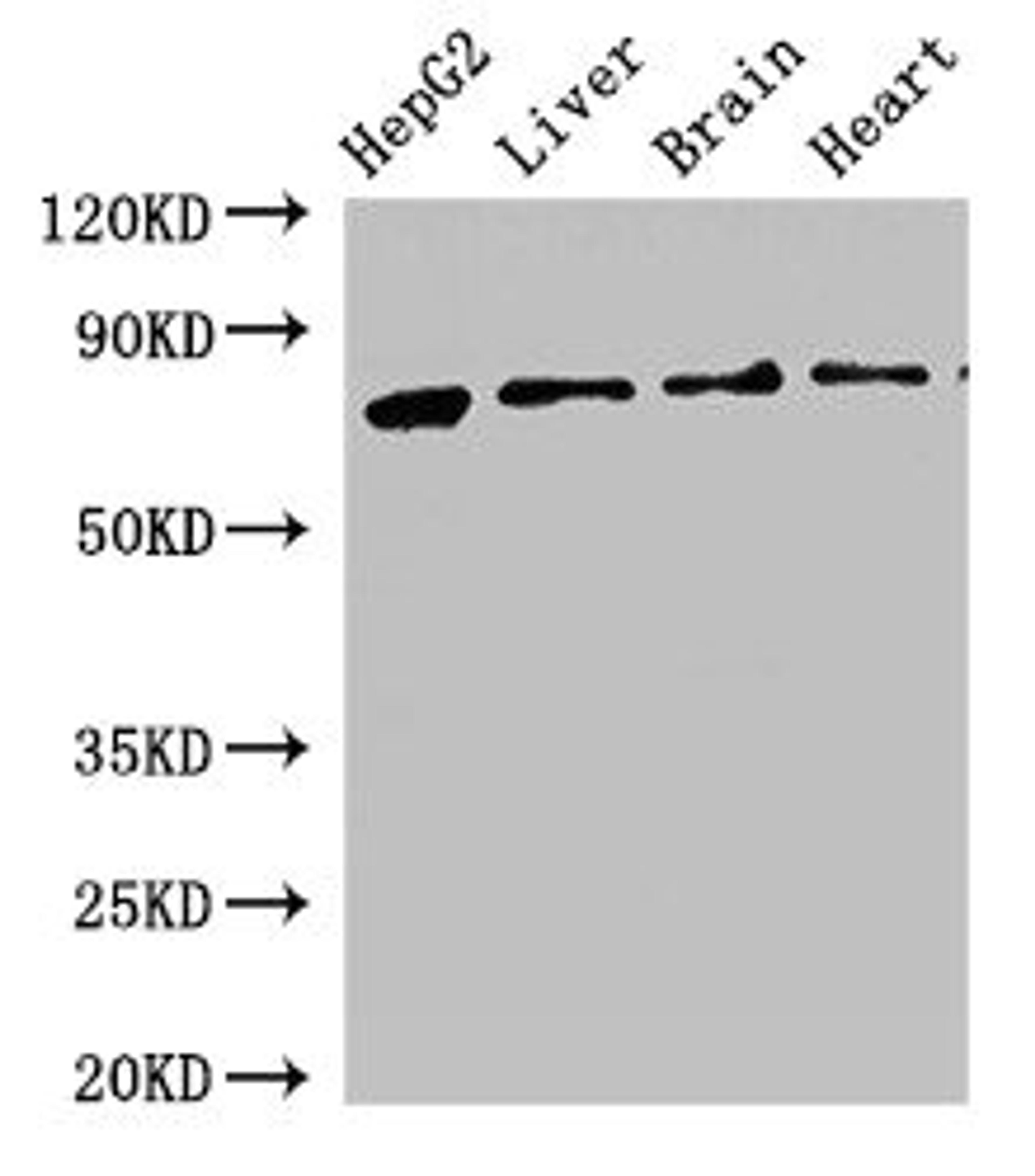 Western Blot. Positive WB detected in: HepG2 whole cell lysate, Rat liver tissue, Rat brain tissue, Mouse heart tissue. All lanes: KLKB1 antibody at 2.5ug/ml. Secondary. Goat polyclonal to rabbit IgG at 1/50000 dilution. Predicted band size: 72 kDa. Observed band size: 72 kDa.