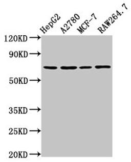Western Blot. Positive WB detected in: HepG2 whole cell lysate, A2780 whole cell lysate, MCF-7 whole cell lysate, RAW264.7 whole cell lysate. All lanes: PRSS8 antibody at 2µg/ml. Secondary. Goat polyclonal to rabbit IgG at 1/50000 dilution. Predicted band size: 37, 31 kDa. Observed band size: 70 kDa