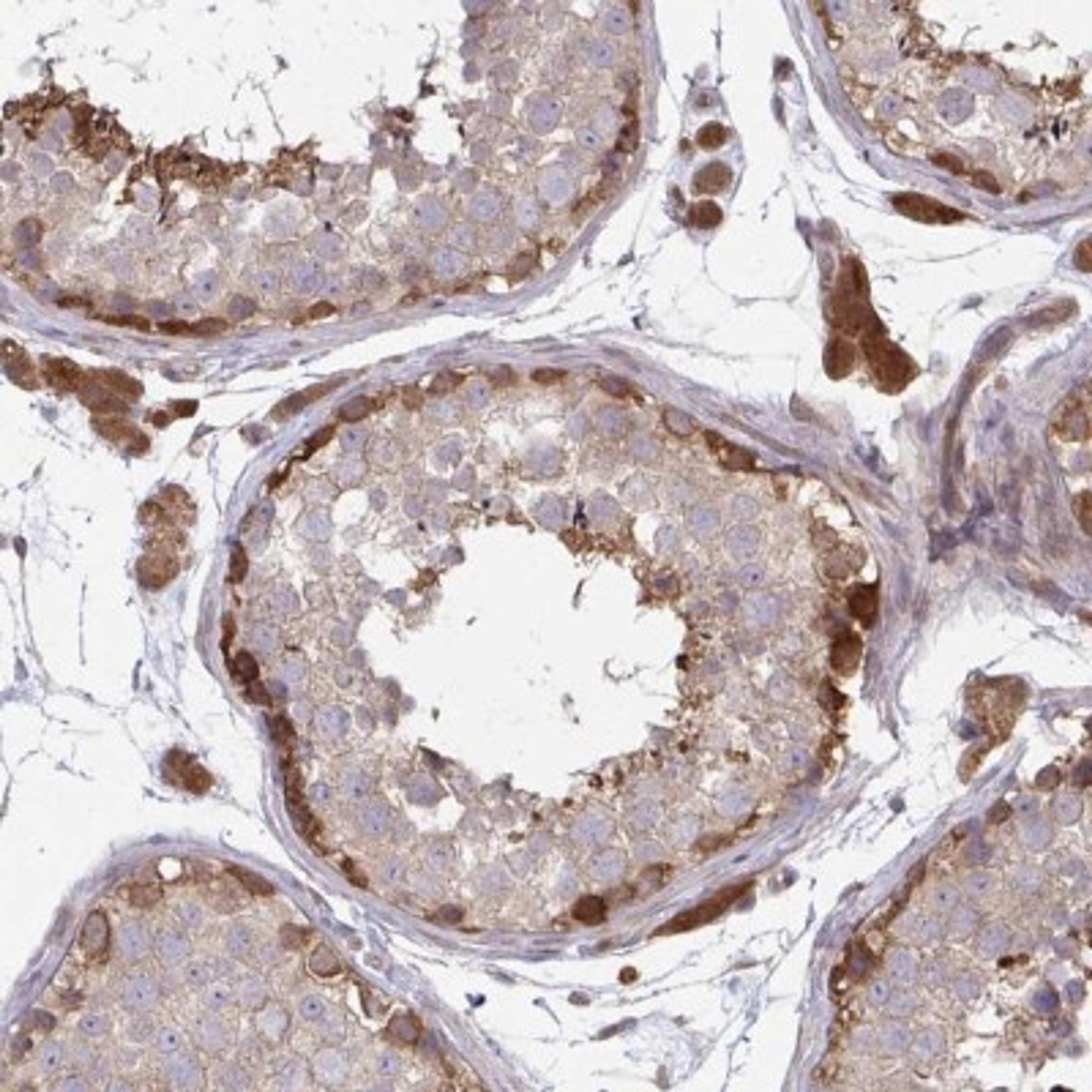 Immunohistochemistry: C11orf35 Antibody [NBP2-31720] - Staining of human testis shows strong cytoplasmic positivity in cells in seminiferus ducts and Leydig cells.