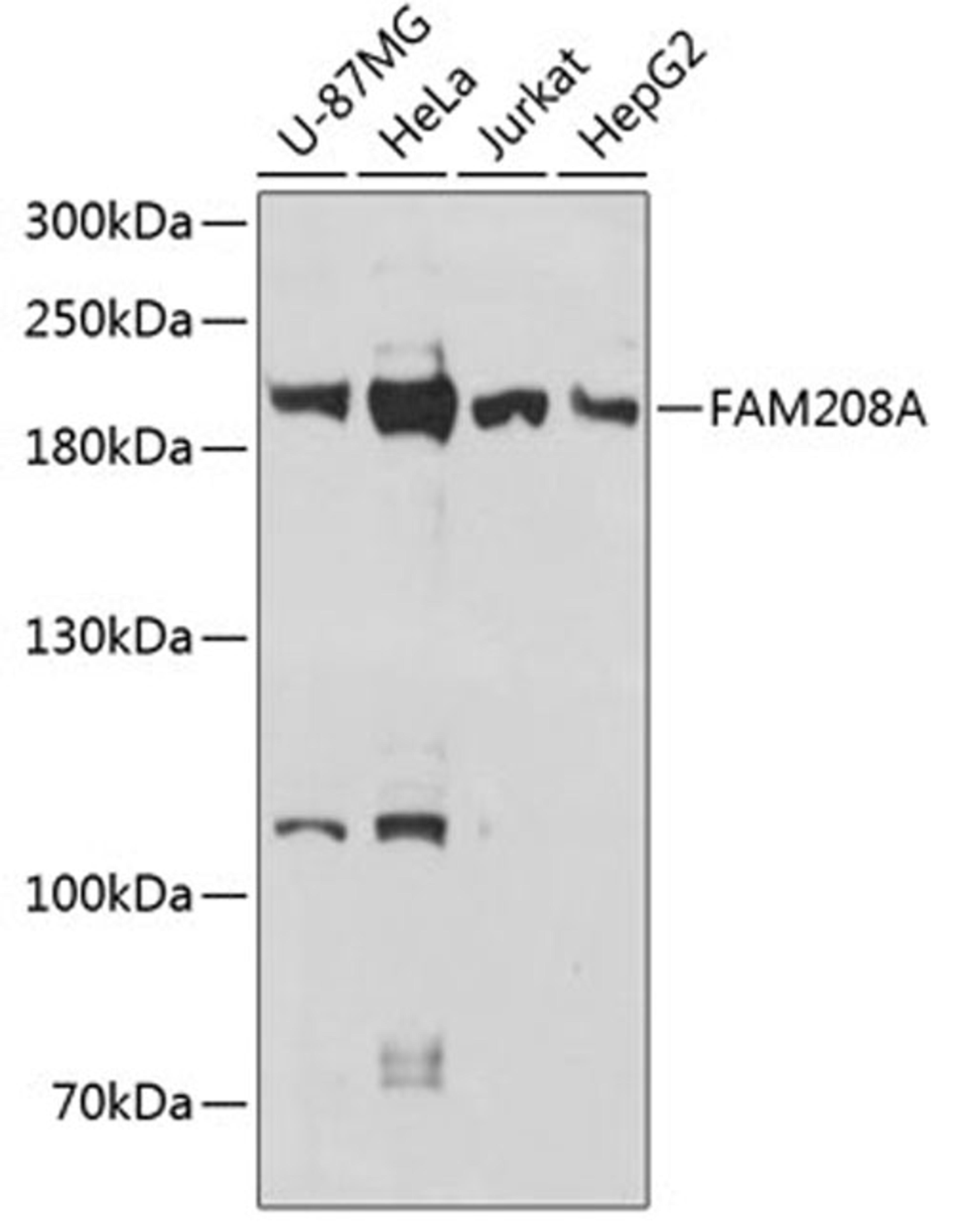 Western blot - FAM208A antibody (A13187)