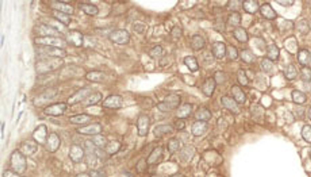 Detection of human NEDD4L by immunohistochemistry.