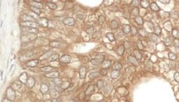 Detection of human NEDD4L by immunohistochemistry.