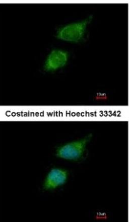 Immunocytochemistry/Immunofluorescence: TRIOBP Antibody [NBP2-20726] - Analysis of paraformaldehyde-fixed HeLa, using antibody at 1:200 dilution.