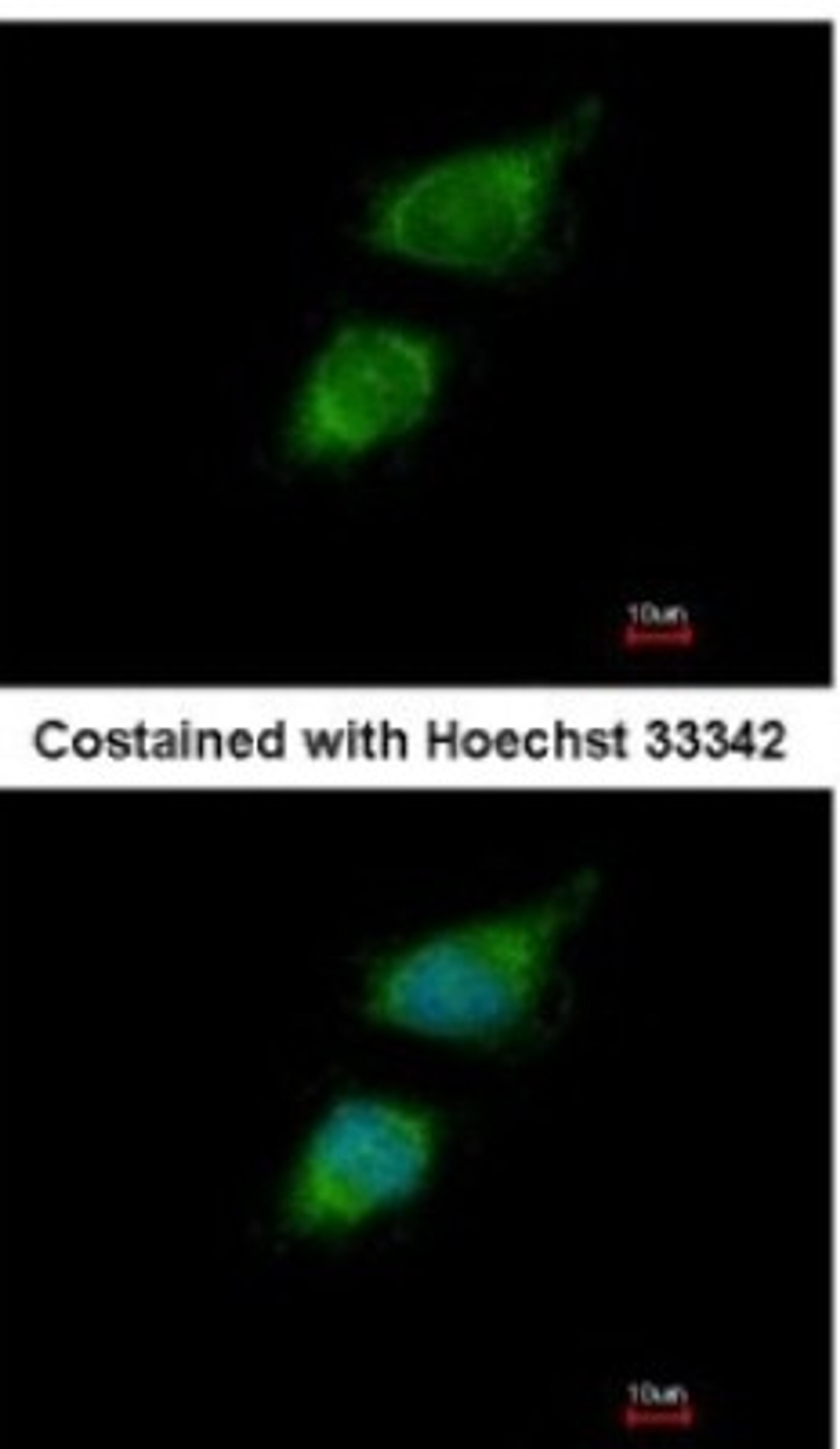 Immunocytochemistry/Immunofluorescence: TRIOBP Antibody [NBP2-20726] - Analysis of paraformaldehyde-fixed HeLa, using antibody at 1:200 dilution.