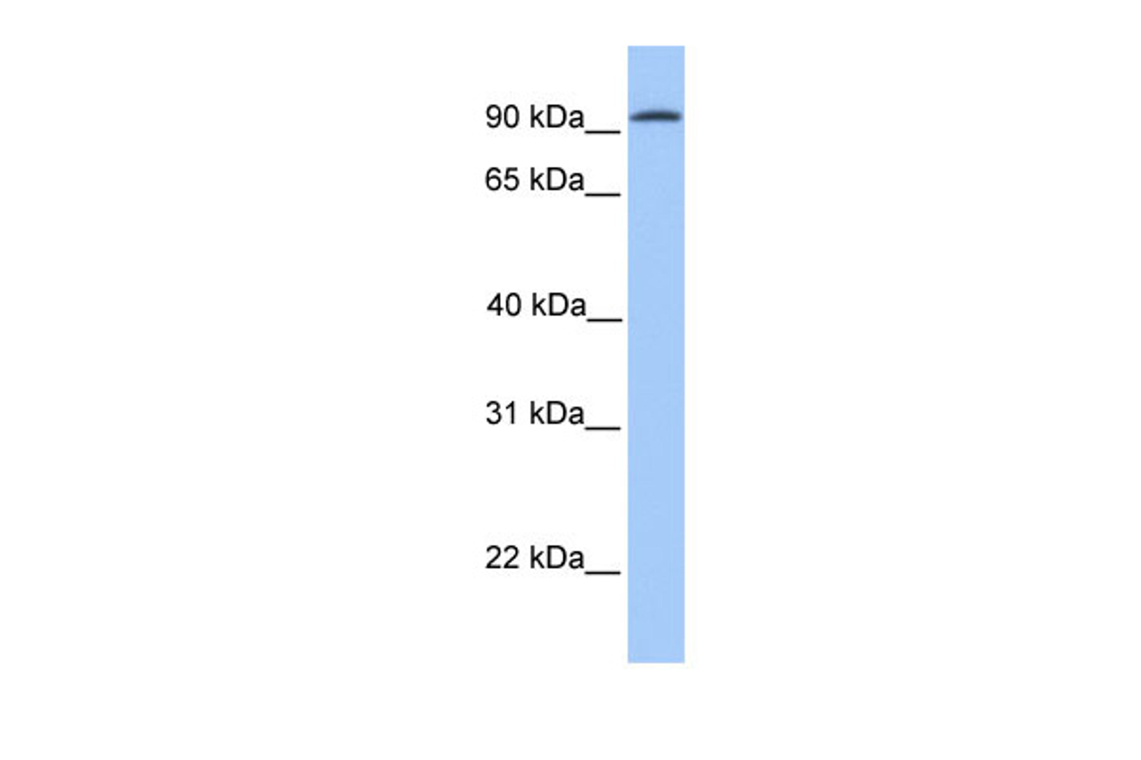 Antibody used in WB on Human brain at 0.2-1 ug/ml.