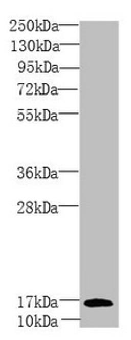 Western blot. All lanes: PEA15 antibody at 1.81 ug/ml + Mouse brain tissue. Secondary. Goat polyclonal to rabbit IgG at 1/10000 dilution. Predicted band size: 16, 18 kDa. Observed band size: 16 kDa. 