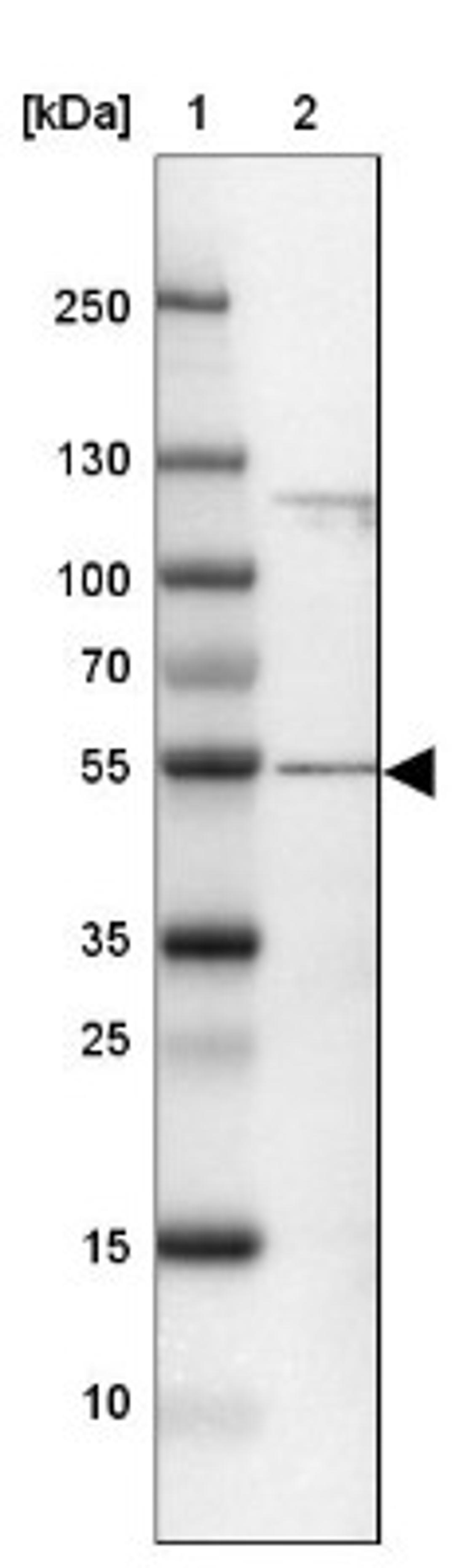 Western Blot: CCDC14 Antibody [NBP2-33998] - Lane 1: Marker [kDa] 250, 130, 100, 70, 55, 35, 25, 15, 10<br/>Lane 2: U-2 OS