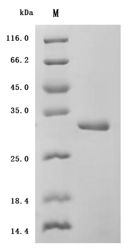 (Tris-Glycine gel) Discontinuous SDS-PAGE (reduced) with 5% enrichment gel and 15% separation gel.