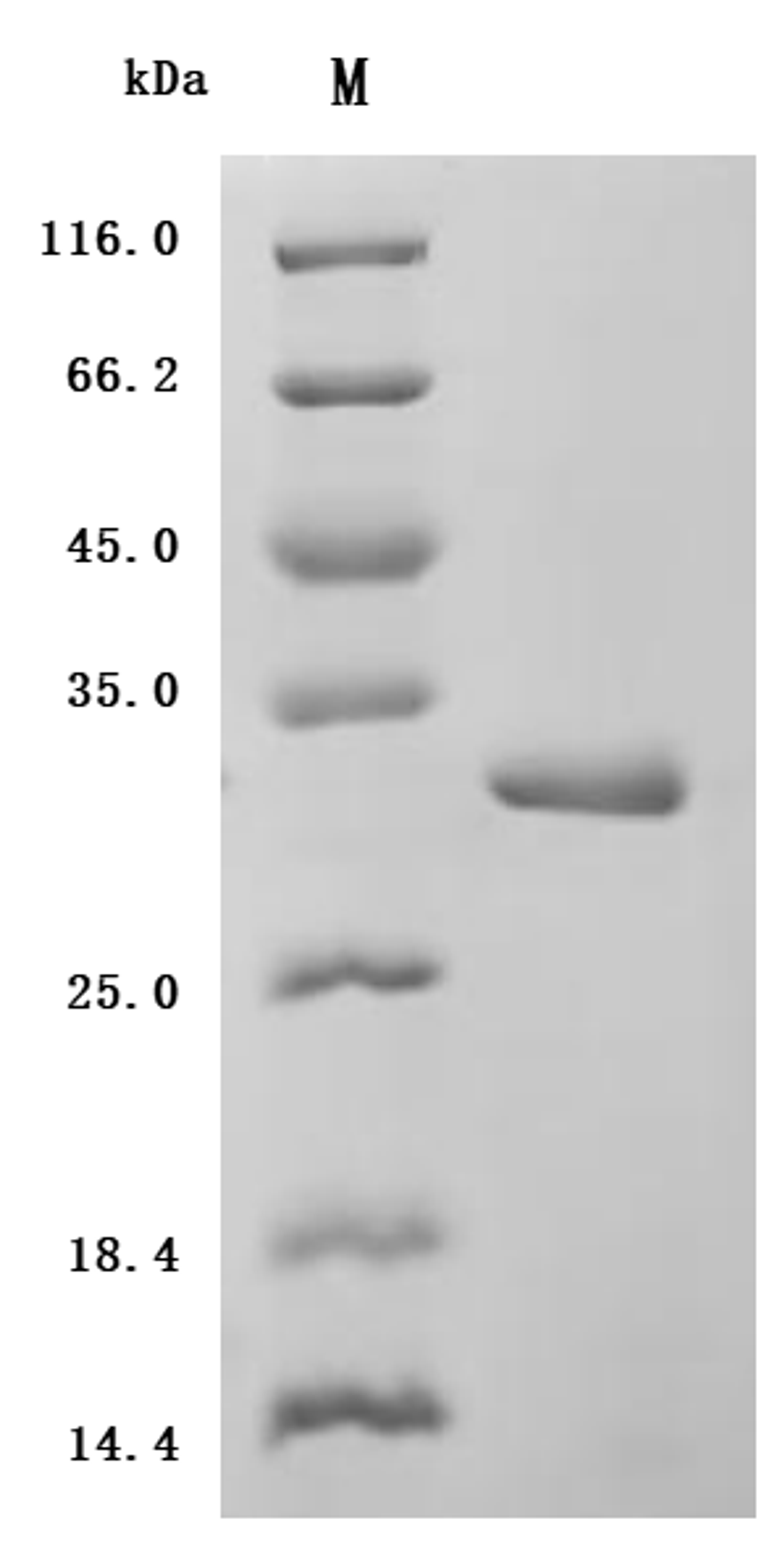 (Tris-Glycine gel) Discontinuous SDS-PAGE (reduced) with 5% enrichment gel and 15% separation gel.