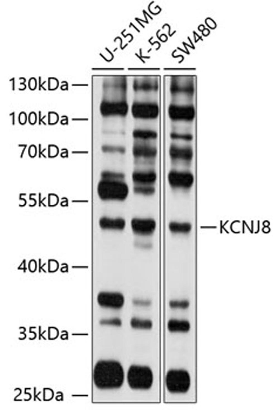 Western blot - KCNJ8 antibody (A10563)