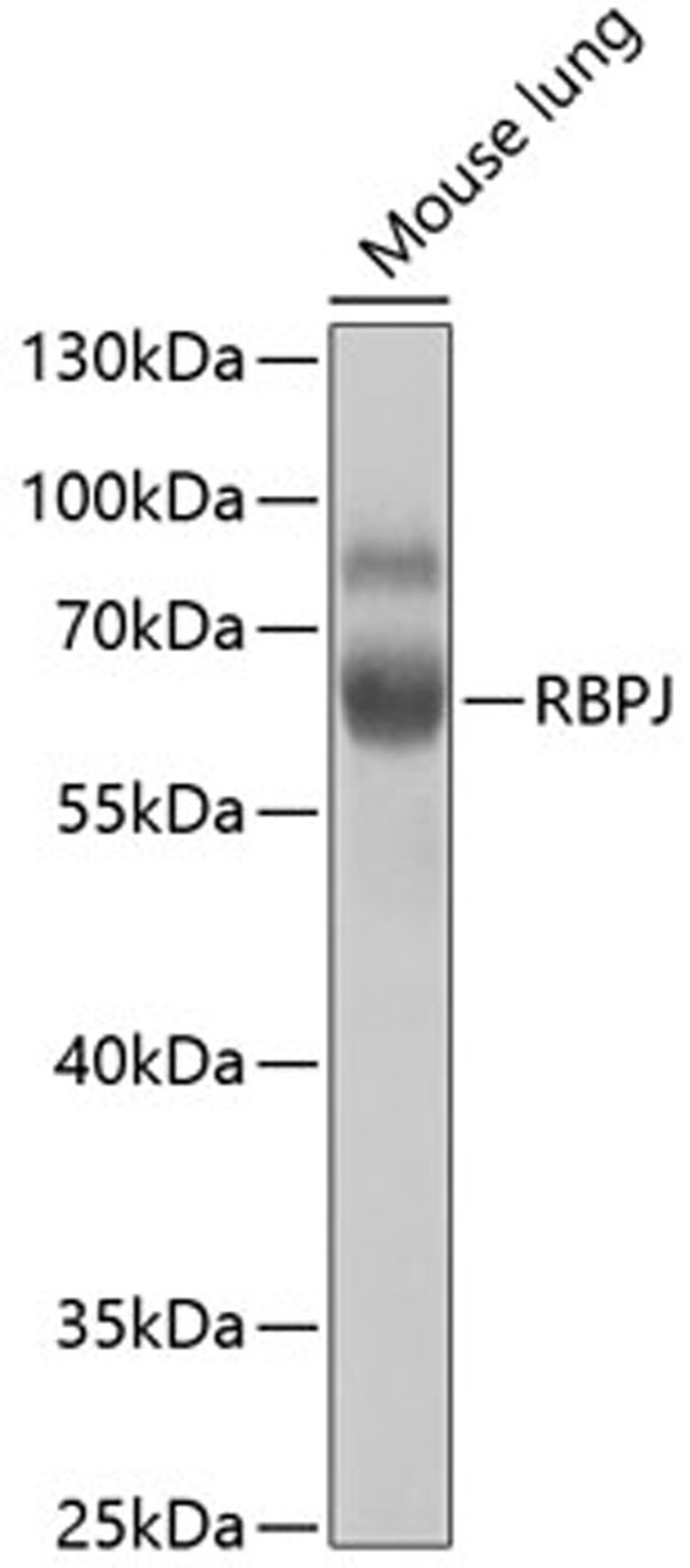 Western blot - RBPJ antibody (A5675)