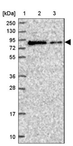 Western Blot: DDHD1 Antibody [NBP2-13903] - Lane 1: Marker [kDa] 250, 130, 95, 72, 55, 36, 28, 17, 10<br/>Lane 2: Human cell line RT-4<br/>Lane 3: Human cell line U-251MG sp