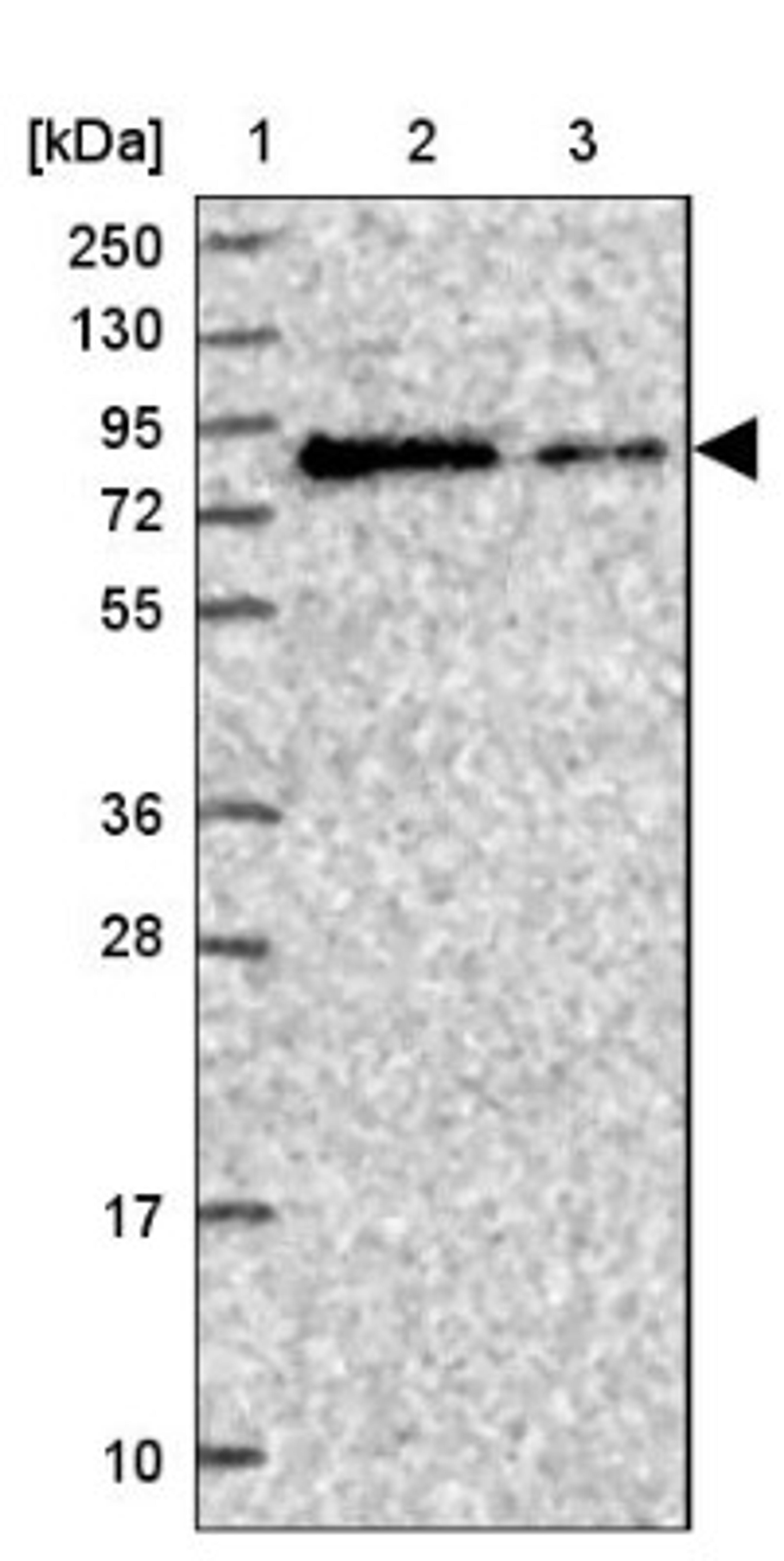 Western Blot: DDHD1 Antibody [NBP2-13903] - Lane 1: Marker [kDa] 250, 130, 95, 72, 55, 36, 28, 17, 10<br/>Lane 2: Human cell line RT-4<br/>Lane 3: Human cell line U-251MG sp