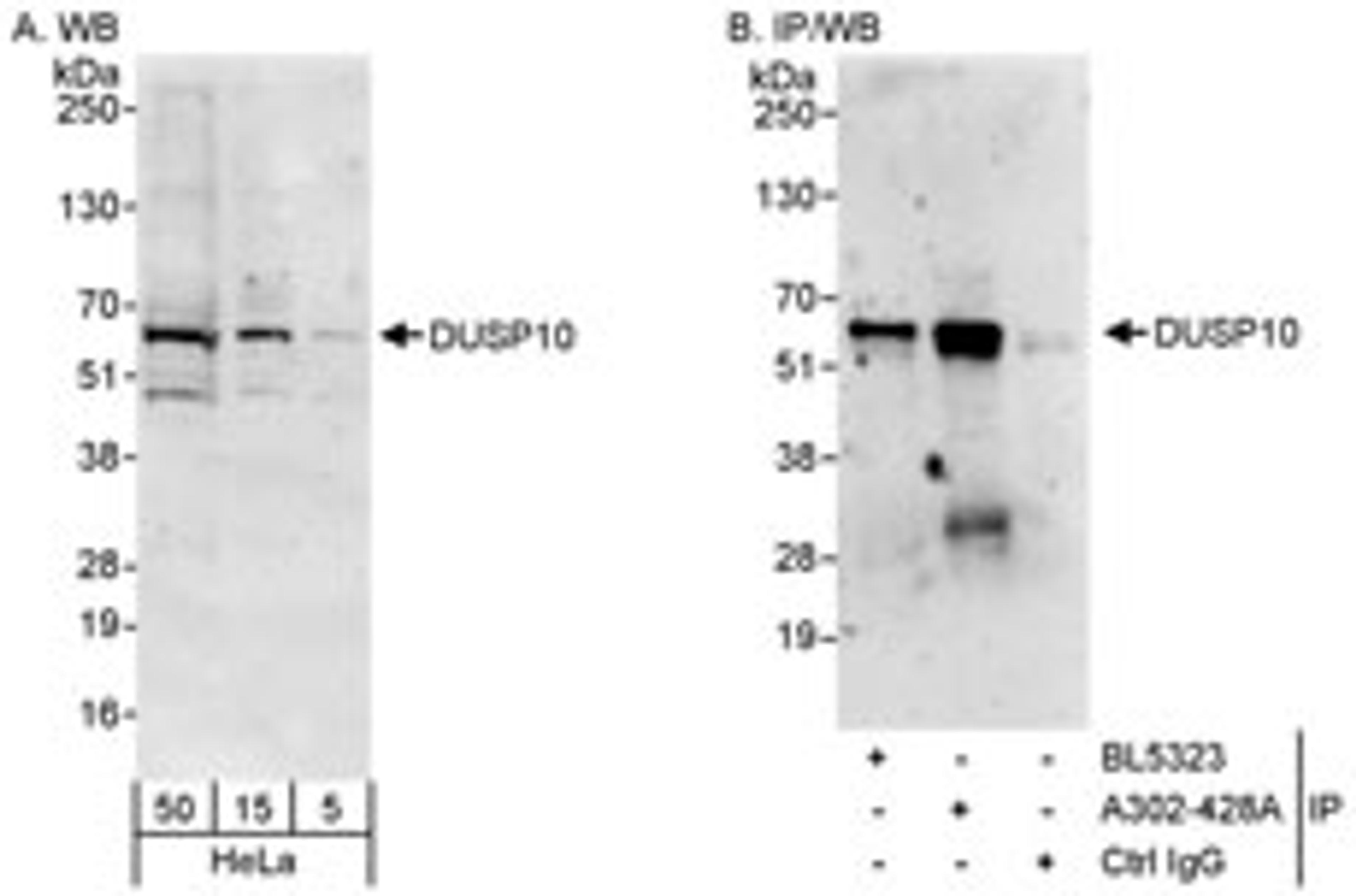 Detection of human DUSP10 by western blot and immunoprecipitation.