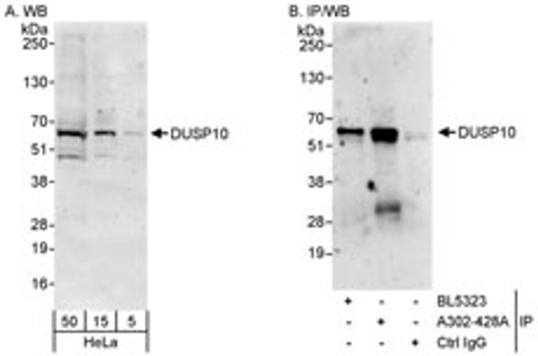 Detection of human DUSP10 by western blot and immunoprecipitation.