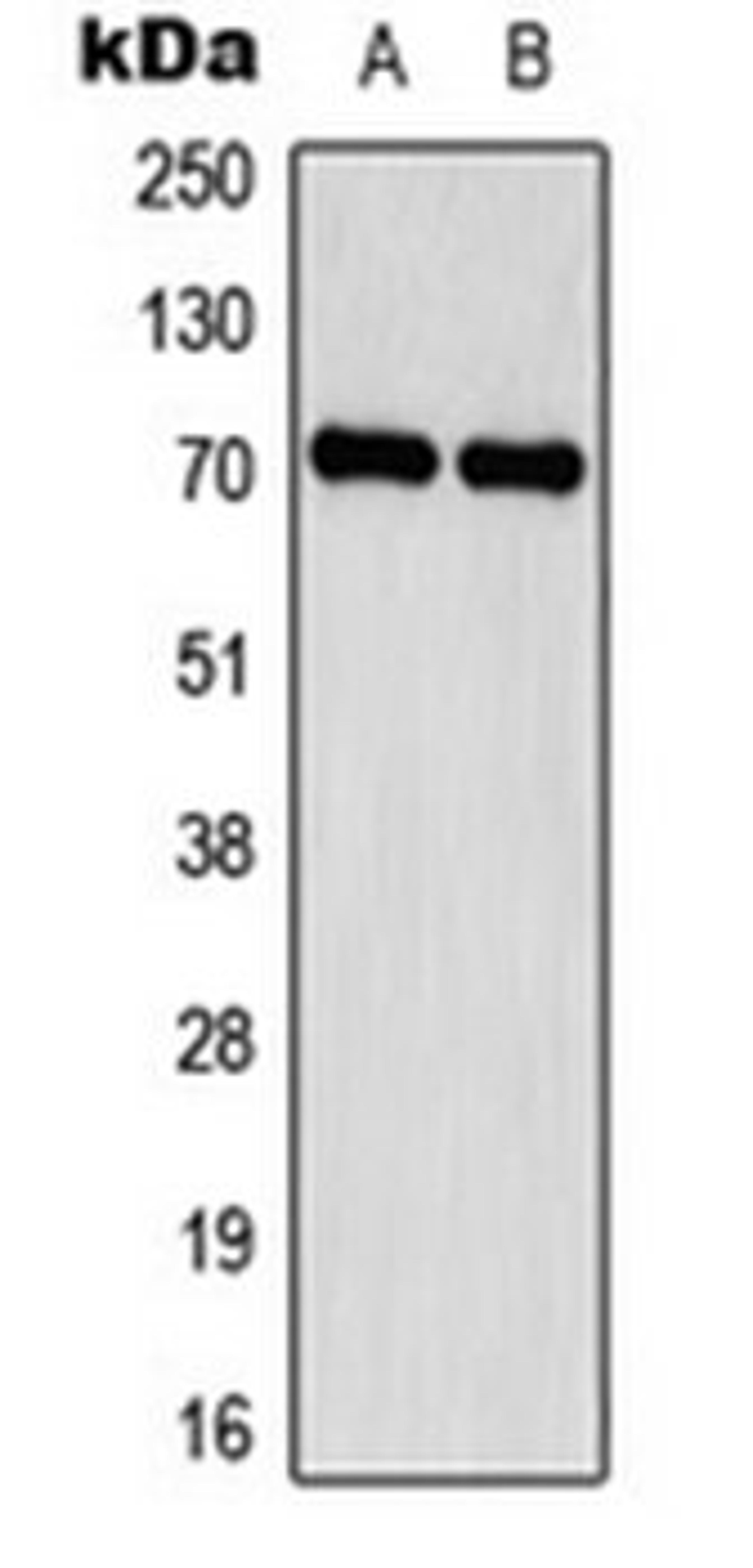 Western blot analysis of HEK293A (Lane 1), MDA-MB231 (Lane 2) whole cell lysates using Delta-NaCH antibody