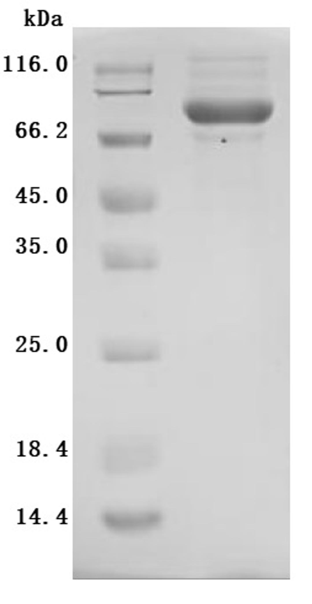 (Tris-Glycine gel) Discontinuous SDS-PAGE (reduced) with 5% enrichment gel and 15% separation gel.