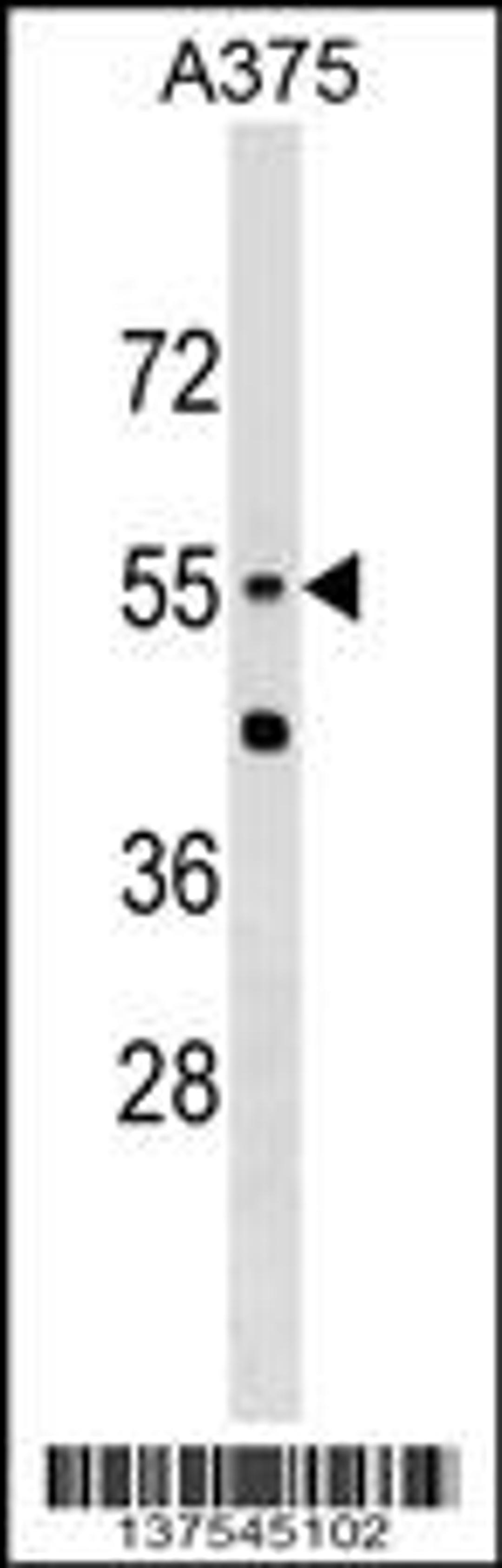 Western blot analysis in A375 cell line lysates (35ug/lane).