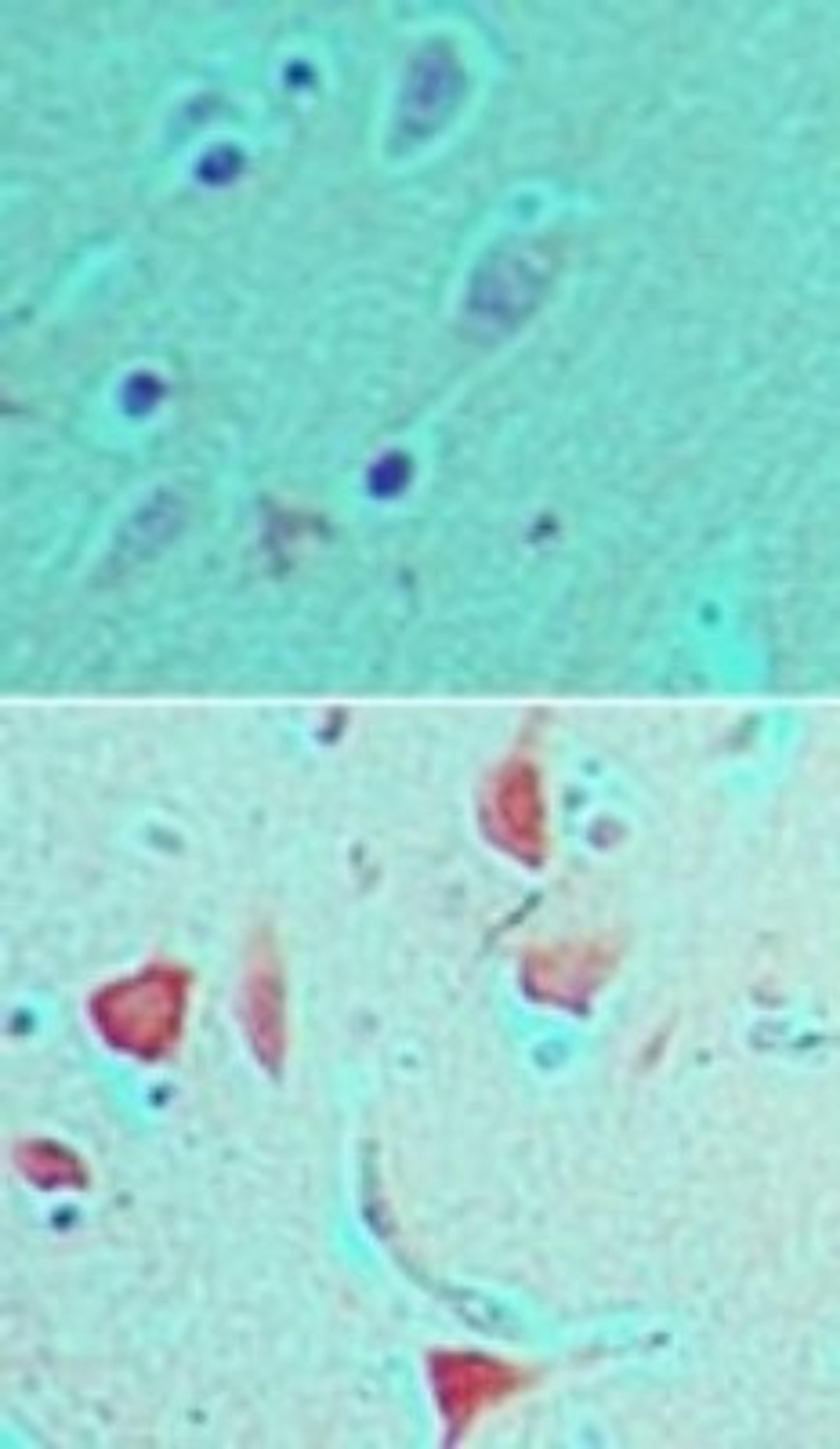 Immunohistochemistry-Paraffin: PER1 Antibody [NBP2-24589] - Immunohistochemical analysis of PER1 in formalin-fixed, paraffin-embedded human brain tissue using an isotype control (top) and NBP2-24589 (bottom) at 5 ug/ml.