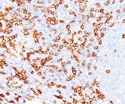 IHC testing of human tonsil (20X) stained with CD8a antibody (C8/468). Note cell surface staining.