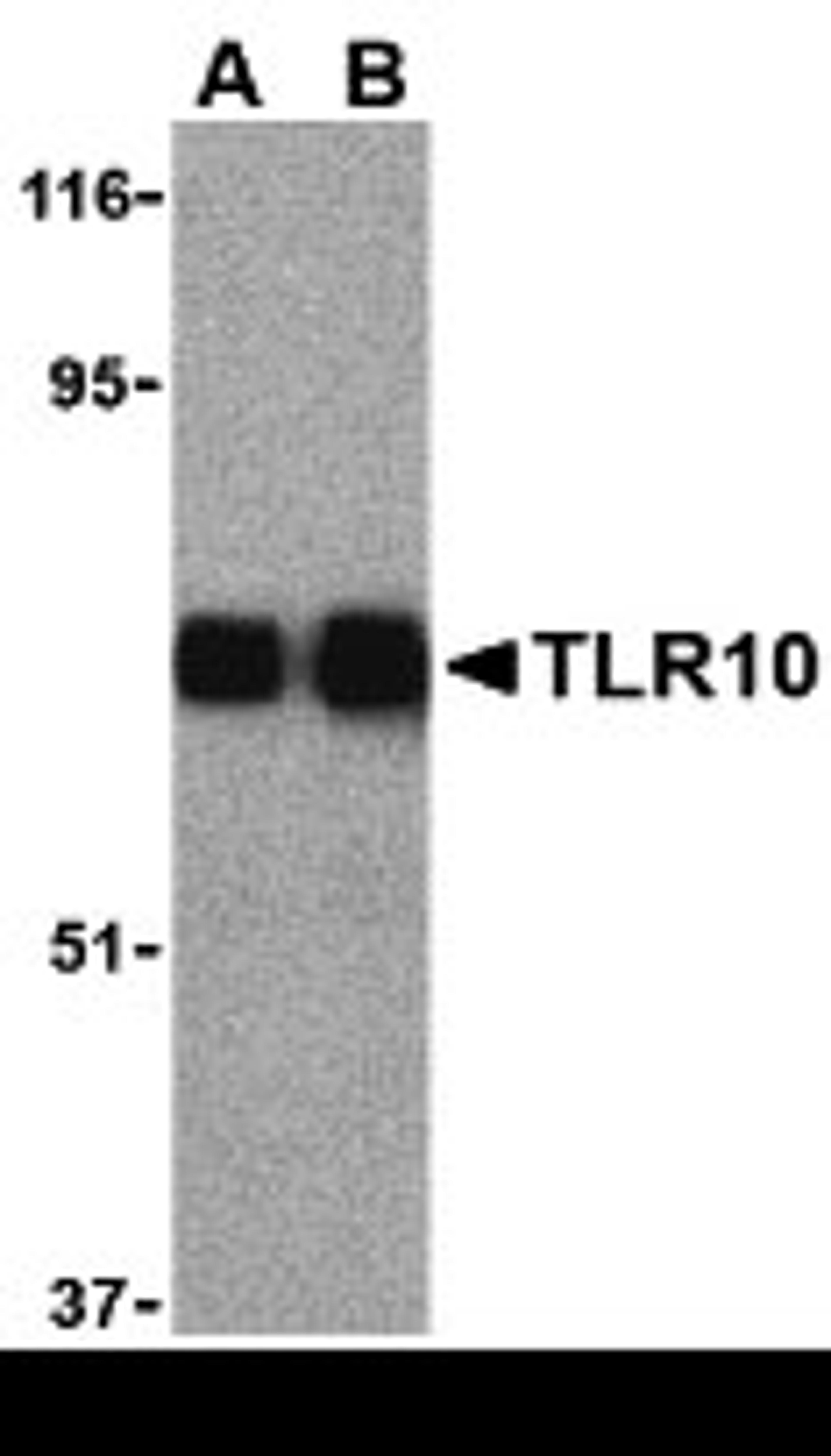 Western blot analysis of TLR10 in human lymph node cell lysates with TLR10 antibody (IN) at (A) 0.5 and (B) 1 μg/mL.