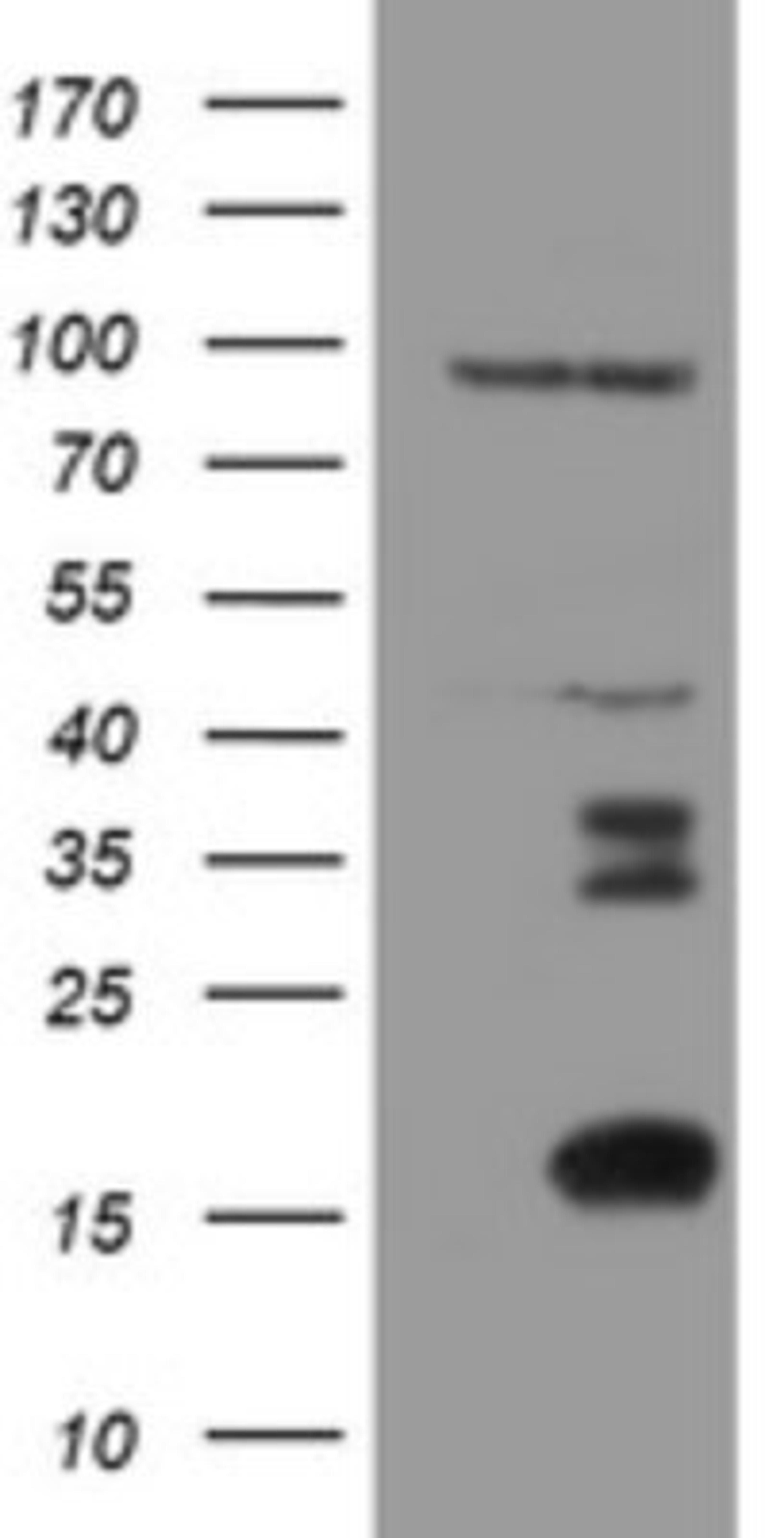 Western Blot: XTP4 Antibody (2D5) [NBP2-46592] - Analysis of HEK293T cells were transfected with the pCMV6-ENTRY control (Left lane) or pCMV6-ENTRY XTP4.