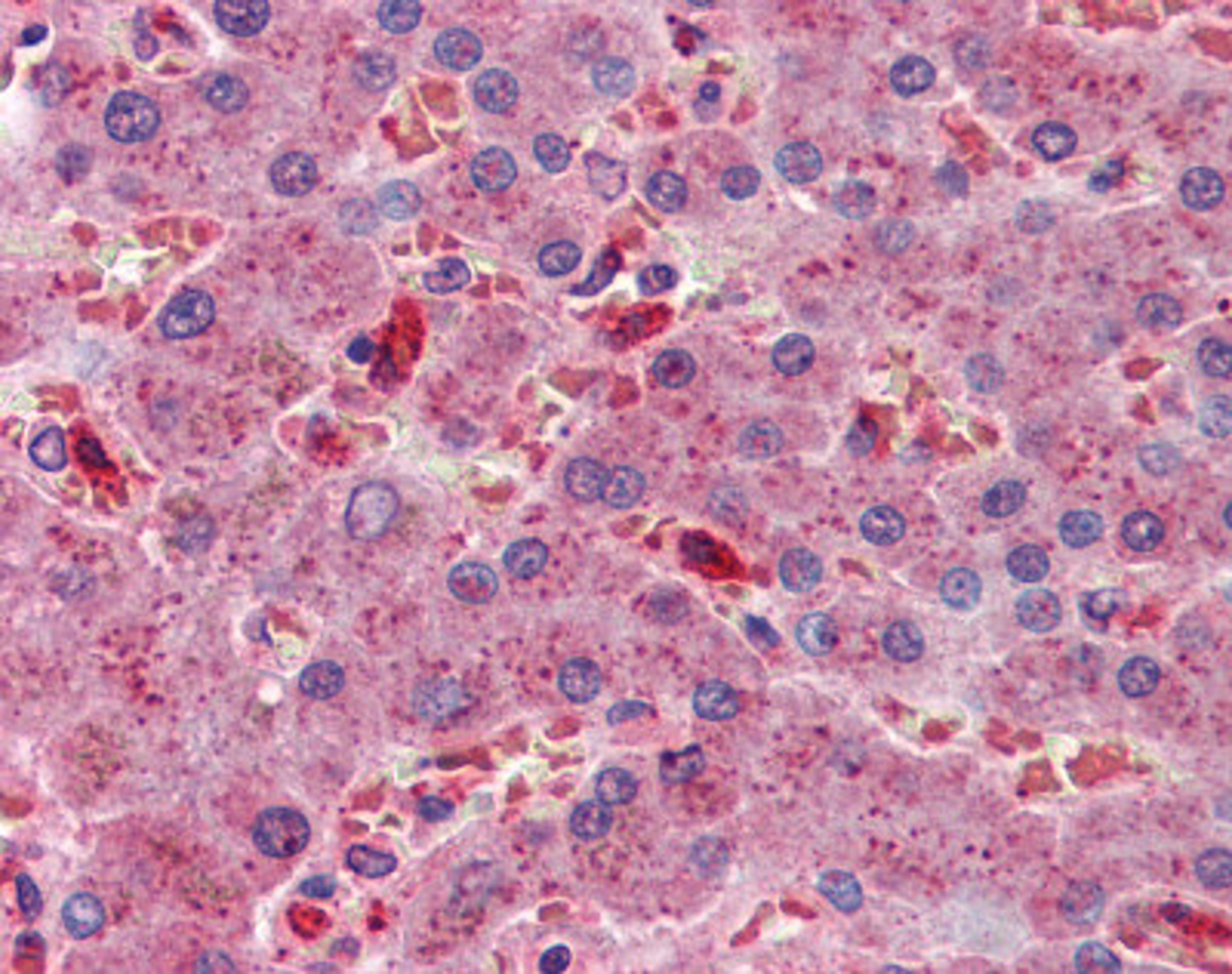 Immunohistochemistry of human liver tissue stained using ALCAM Monoclonal Antibody.