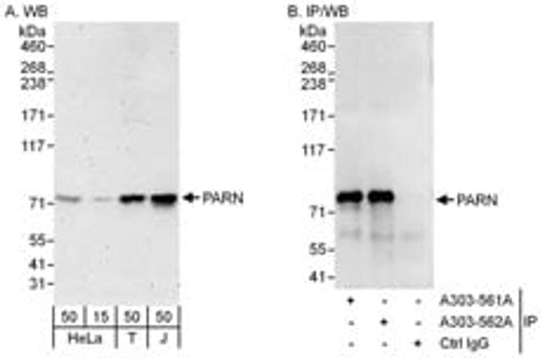 Detection of human PARN by western blot and immunoprecipitation.