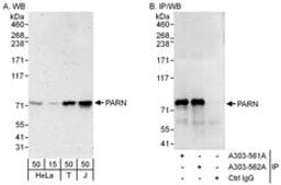 Detection of human PARN by western blot and immunoprecipitation.