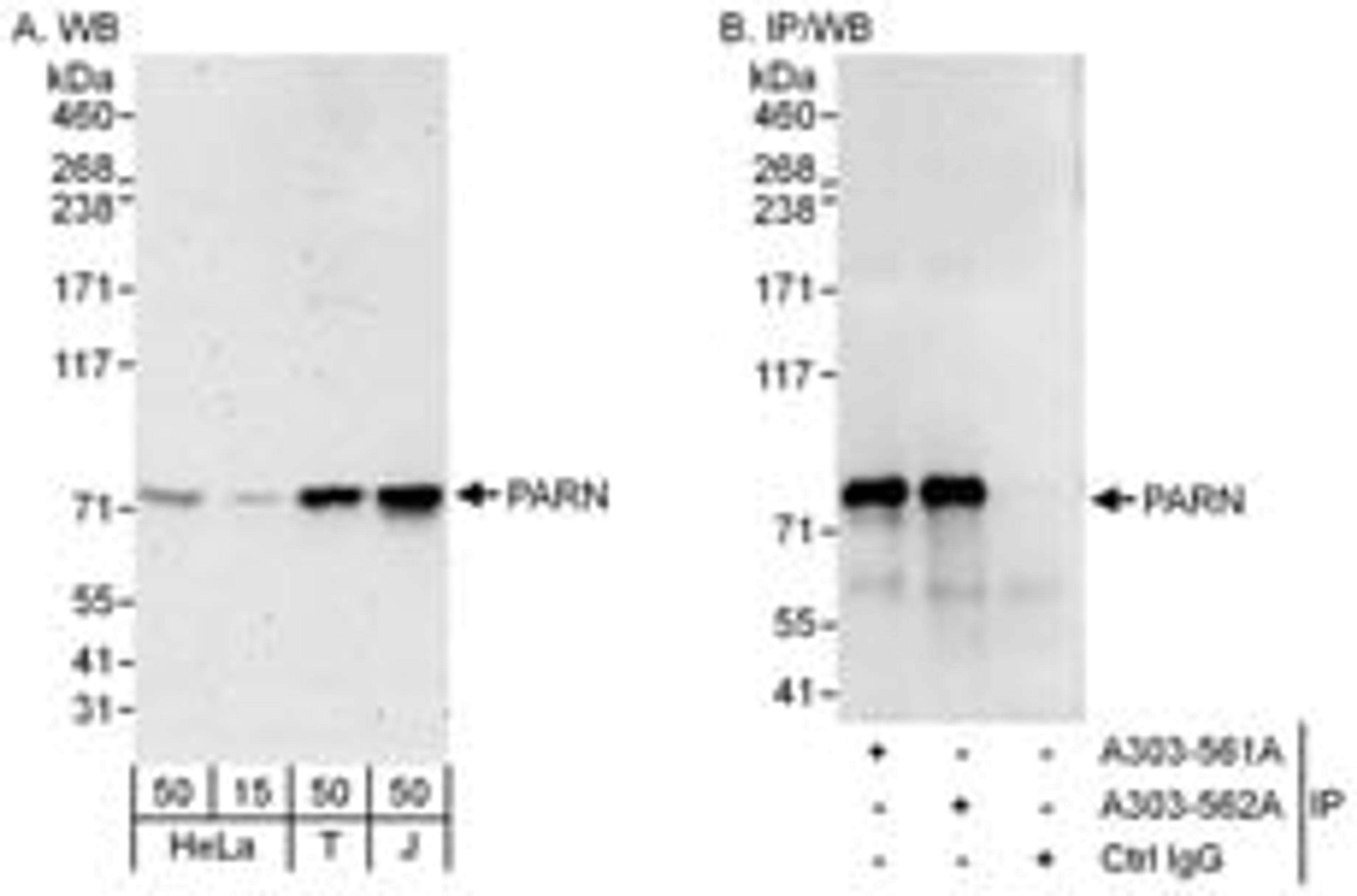 Detection of human PARN by western blot and immunoprecipitation.