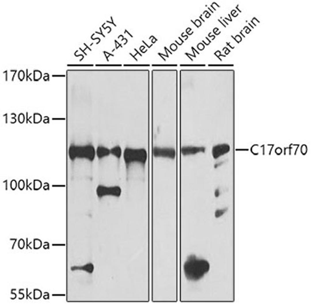 Western blot - C17orf70 antibody (A8591)