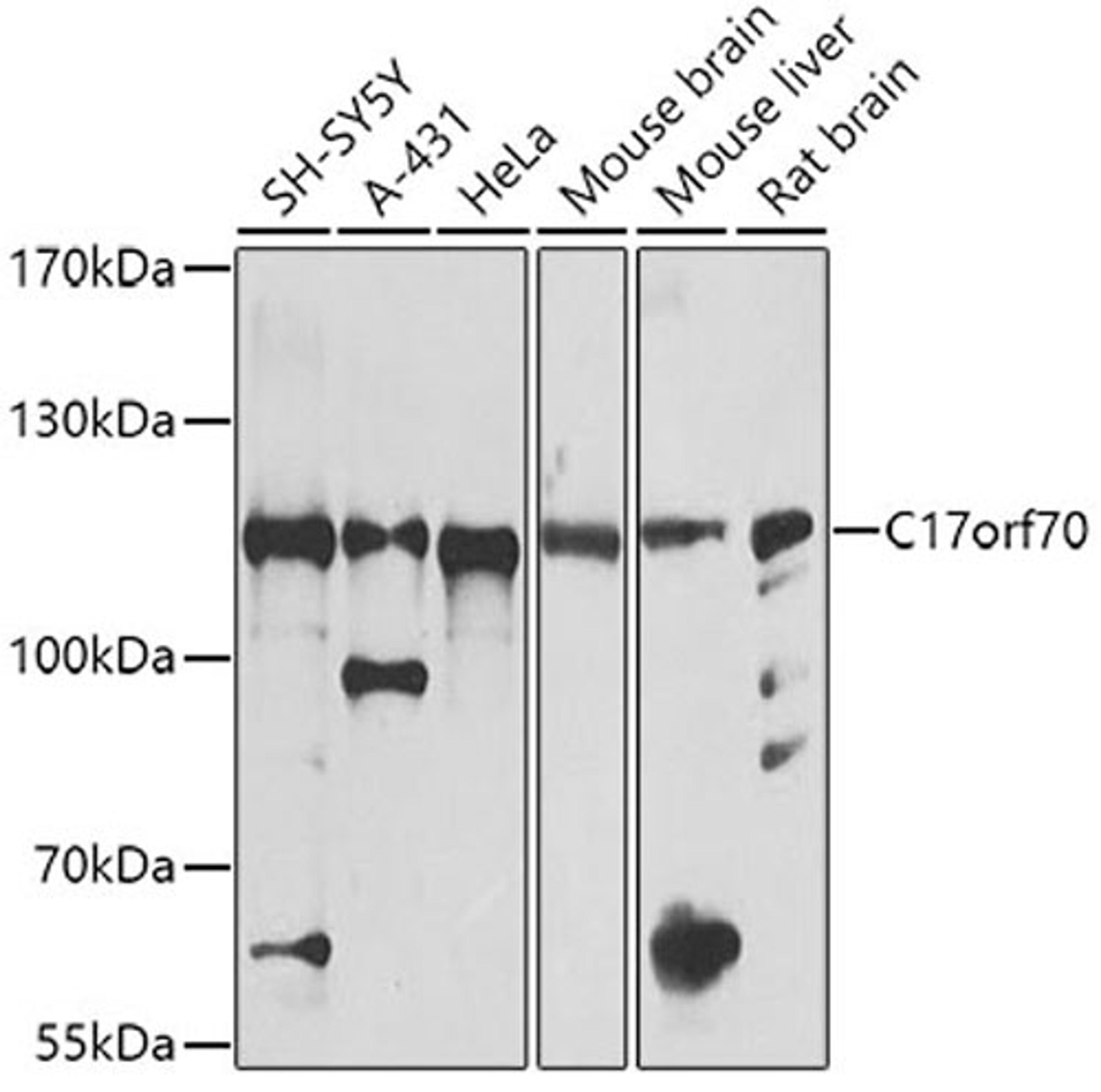 Western blot - C17orf70 antibody (A8591)