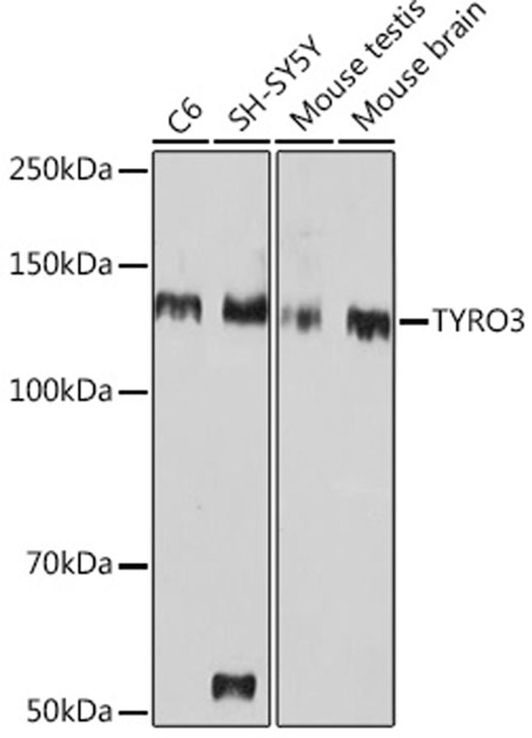 Western blot - TYRO3 Rabbit mAb (A0730)