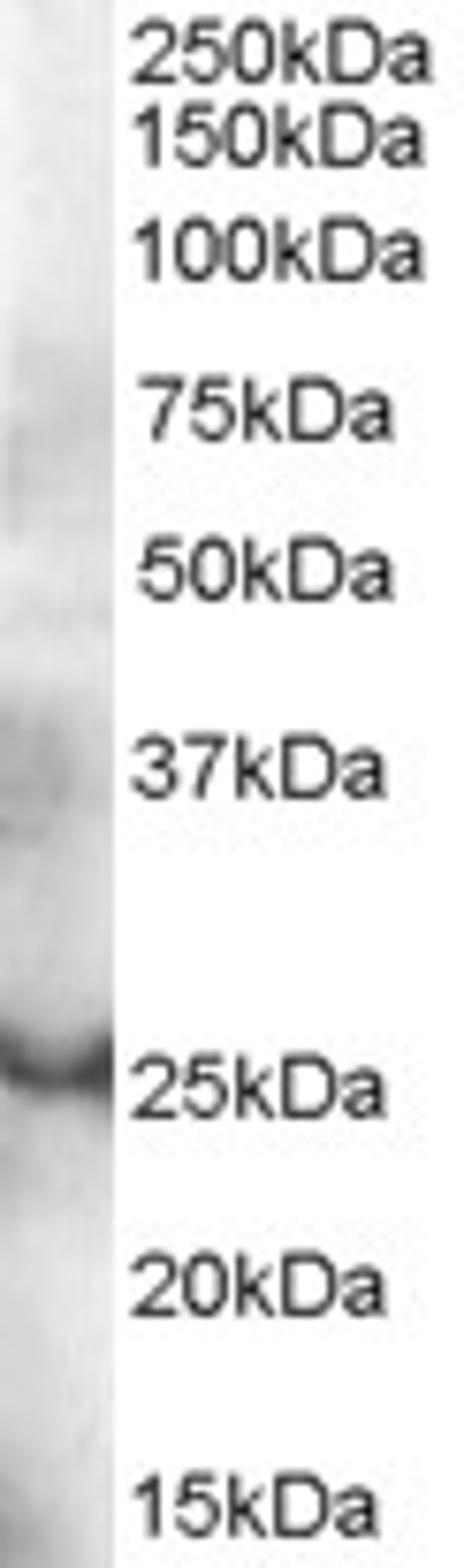 45-704 (0.3ug/ml) staining of human thymus lysate (35ug protein in RIPA buffer). Primary incubation was 1 hour. Detected by chemiluminescence.