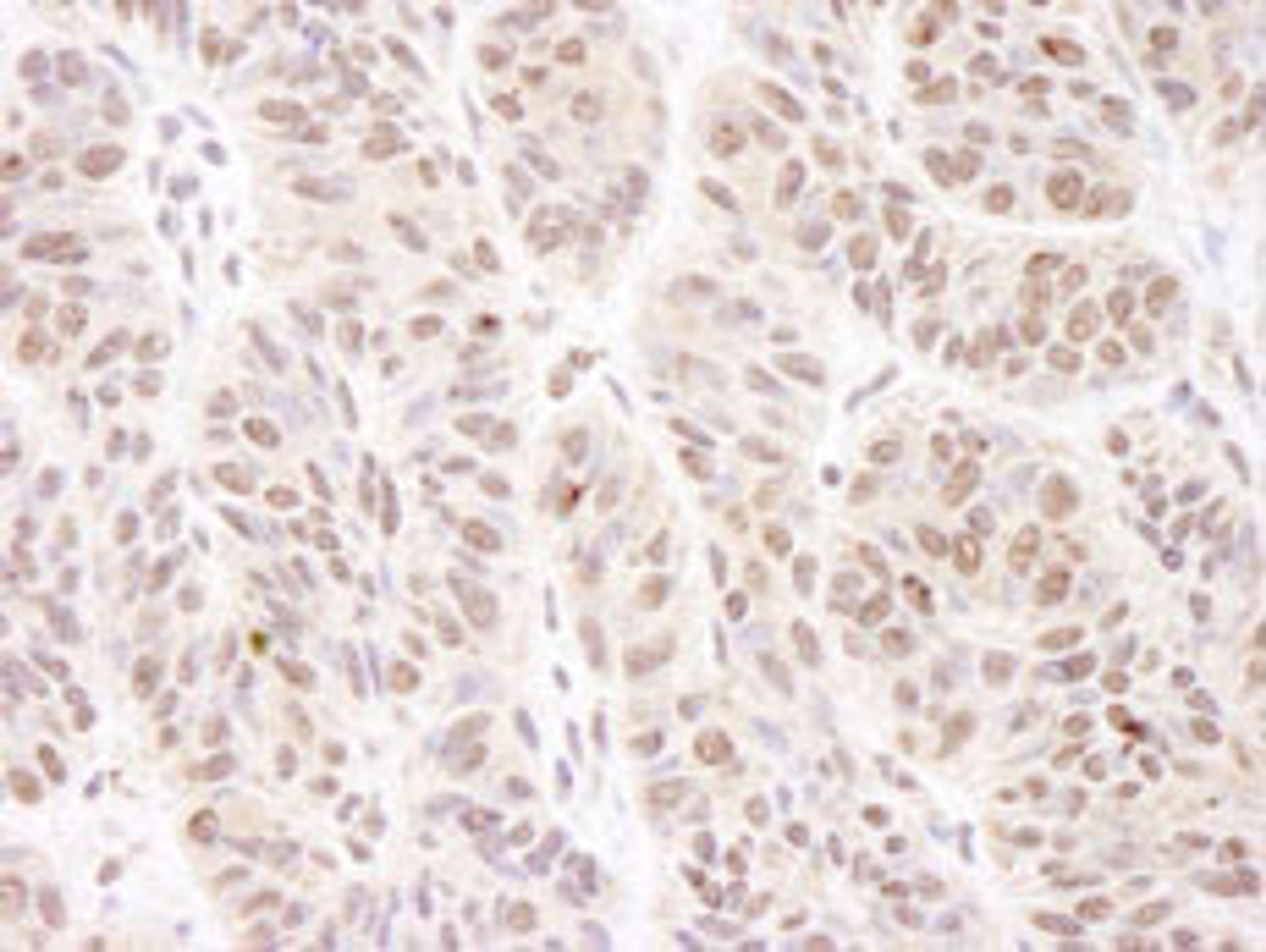 Detection of human BTF by immunohistochemistry.