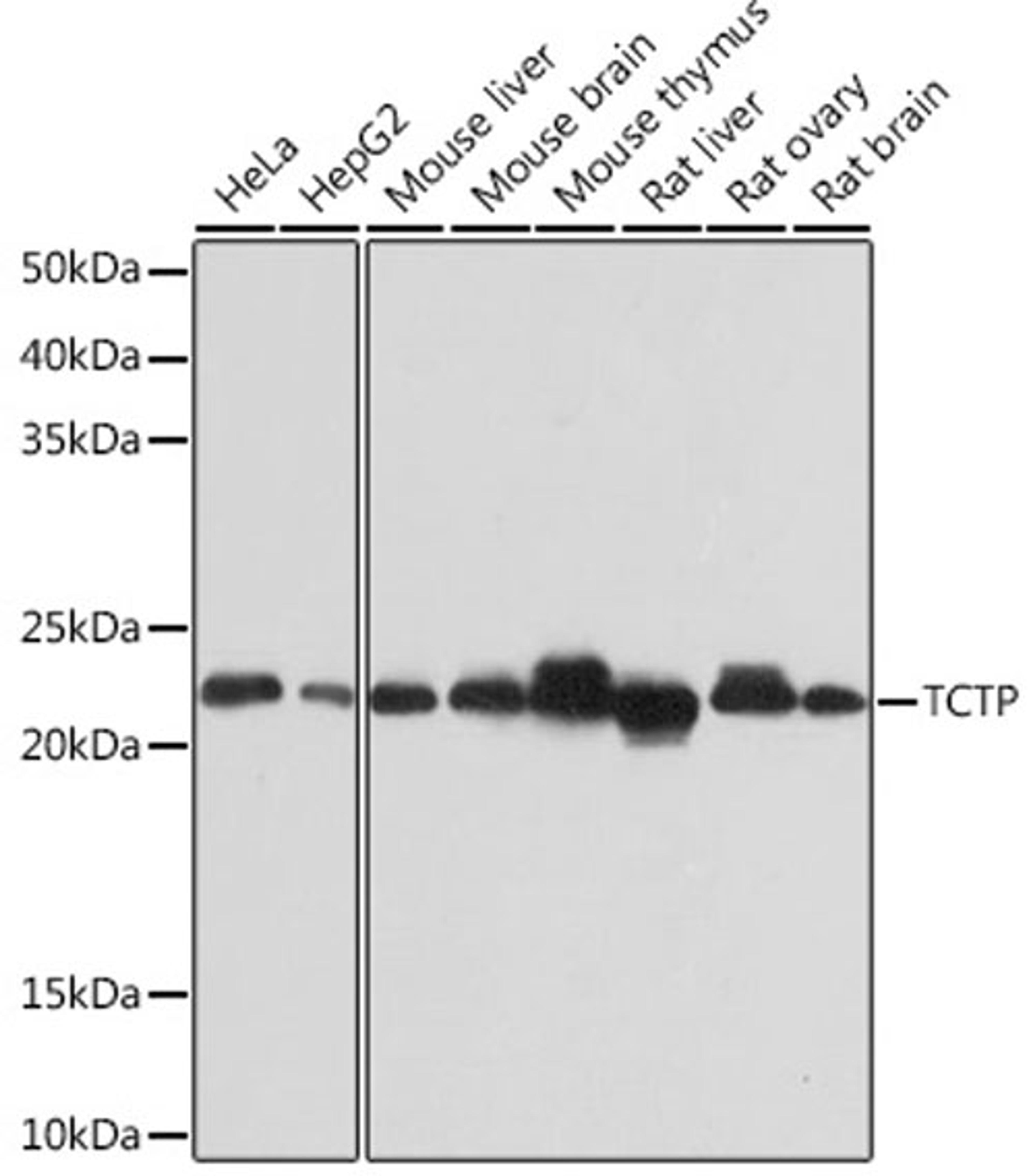 Western blot - TCTP Rabbit mAb (A2394)