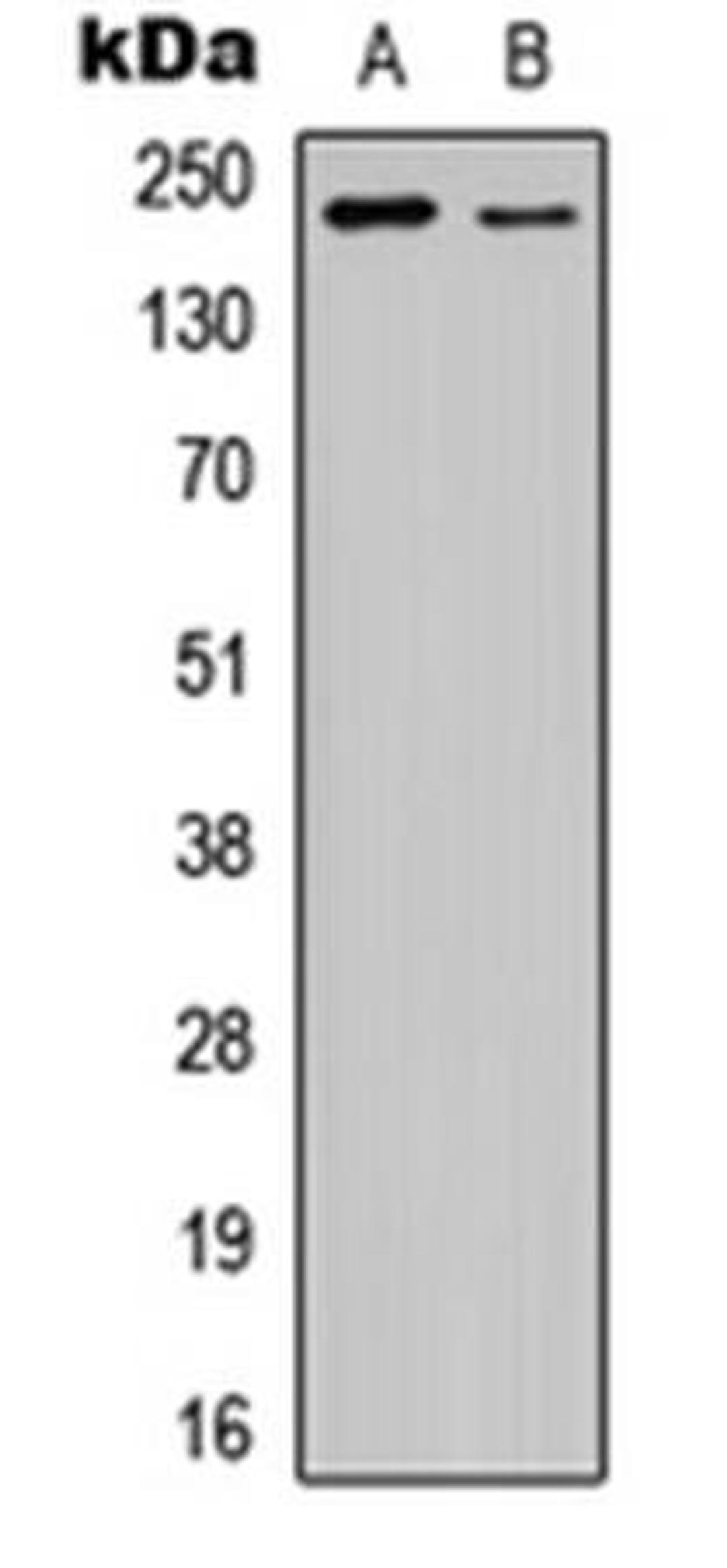 Western blot analysis of HEK293T EGF-treated (Lane1), NIH3T3 EGF-treated (Lane2) whole cell using VEGFR2 (phospho-Y1175) antibody