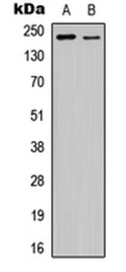 Western blot analysis of HEK293T EGF-treated (Lane1), NIH3T3 EGF-treated (Lane2) whole cell using VEGFR2 (phospho-Y1175) antibody