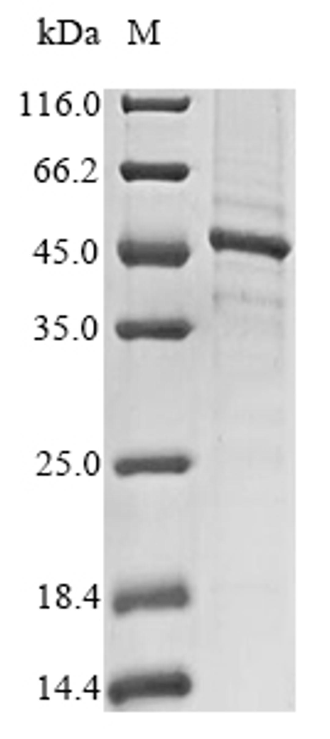 (Tris-Glycine gel) Discontinuous SDS-PAGE (reduced) with 5% enrichment gel and 15% separation gel.
