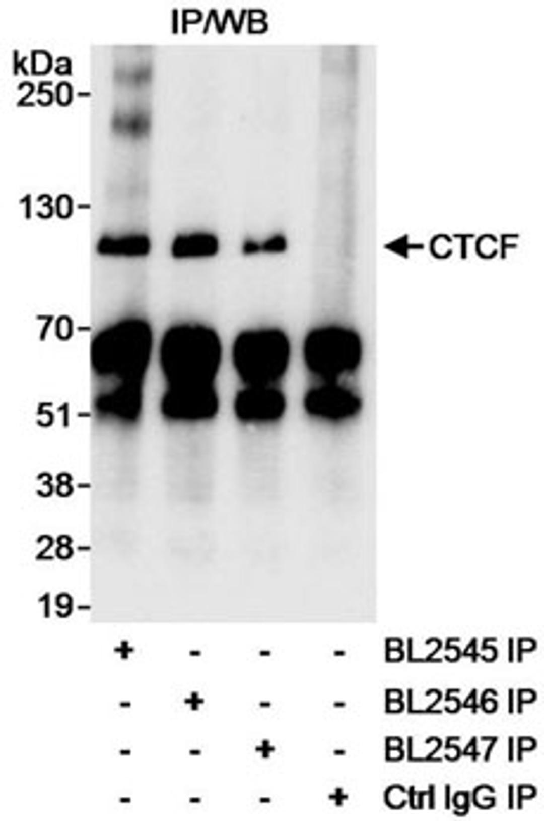 immunoprecipitation of human CTCF.