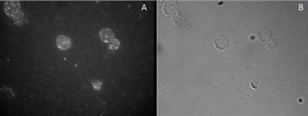 Immunohistochemistry: FoxP3 Antibody [NB600-242] - Staining of CD25-sorted (Treg) human blood cells gathered by cytospin and detected by FITC (A) and in phase contrast (B).