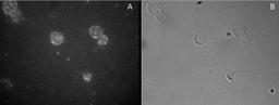 Immunohistochemistry: FoxP3 Antibody [NB600-242] - Staining of CD25-sorted (Treg) human blood cells gathered by cytospin and detected by FITC (A) and in phase contrast (B).