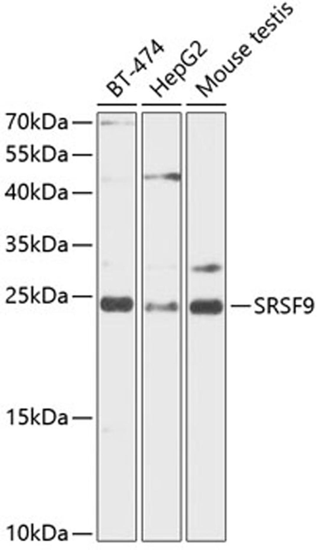 Western blot - SRSF9 antibody (A12538)