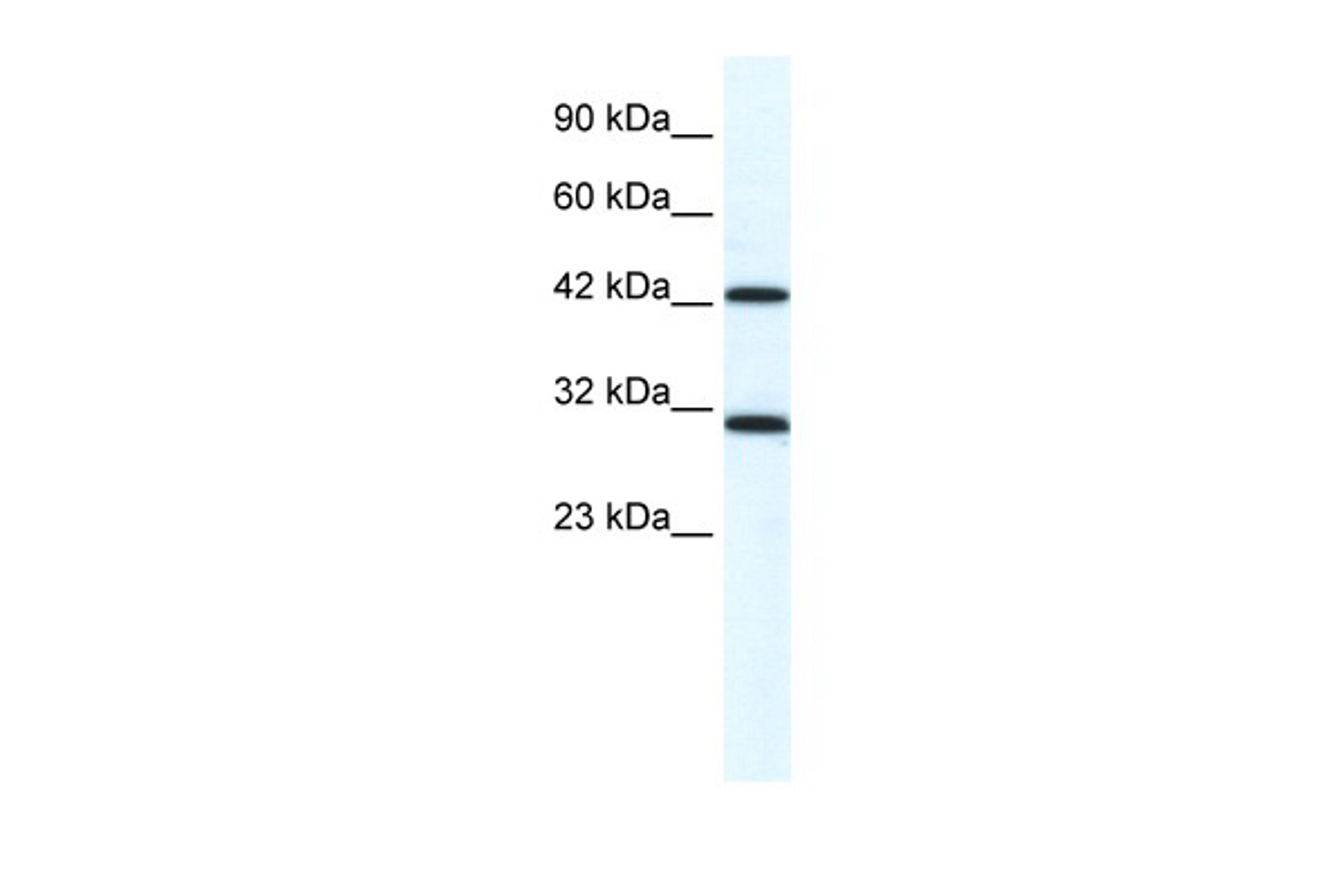 Antibody used in WB on Human HepG2 at 1.25 ug/ml.