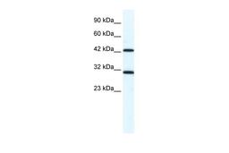 Antibody used in WB on Human HepG2 at 1.25 ug/ml.